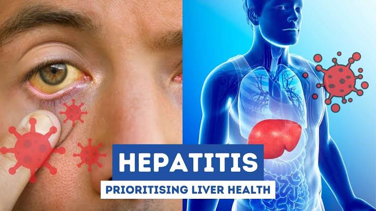 Rise in Hepatitis Cases Prompts Health Alert Across State
